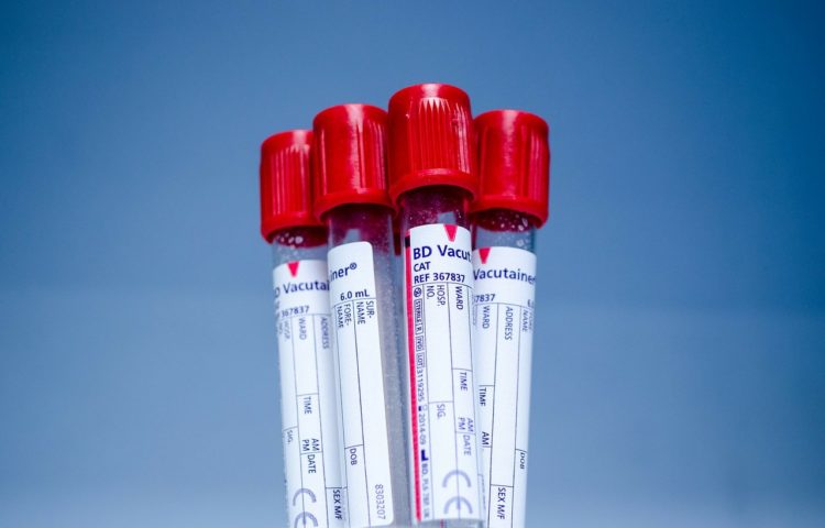 Zrób test na HIV, HCV i kiłę w Toruniu lub Bydgoszczy